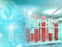 Υπερκαλιαιμία: Τι σημαίνει το αυξημένο κάλιο στο αίμα και οι πιθανές αιτίες