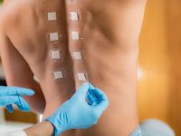 Αλλεργικές αντιδράσεις: Πώς γίνεται ένα τεστ επικόλλησης στο δέρμα