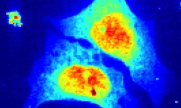 Η πρώτη ακτινογραφία ζωντανού κυττάρου