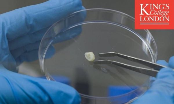 Κατασκεύασαν δόντια από τα κύτταρα των ούλων