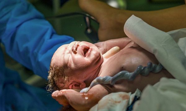 Τι είναι οι κύστεις του ομφαλίου λώρου
