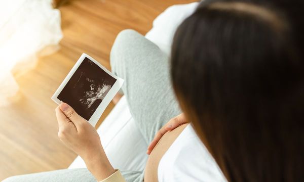 Μονήρης ομφαλική αρτηρία: Τι είναι και ποιες οι επιπτώσεις στο έμβρυο;