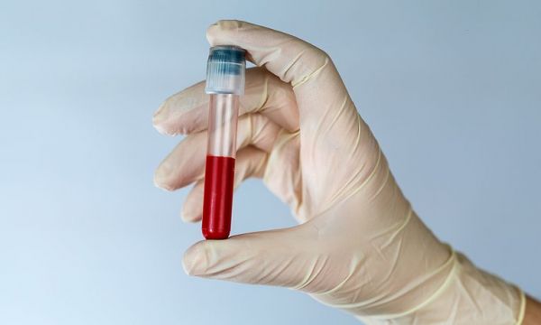 Συμμετοχή της Ελλάδας σε πολυκεντρική μελέτη μονοκλωνικού αντισώματος για τη θεραπεία της COVID-19
