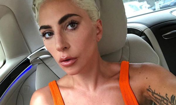11 celebrities που δε διστάζουν να δείξουν τις ραγάδες τους