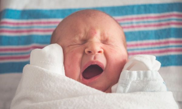 Σημάδια εκ γενετής στα βρέφη: Όλα όσα πρέπει να γνωρίζετε