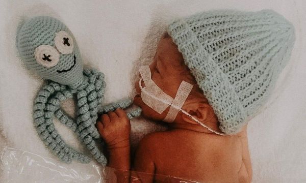 Πλεχτά χταποδάκια για πρόωρα μωρά - Πού θα τα βρείτε στην Ελλάδα