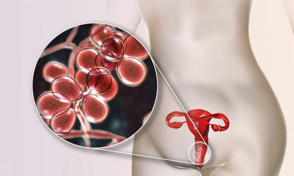 Βακτηριακή κολπίτιδα: Συμπτώματα, αντιμετώπιση, επιπλοκές