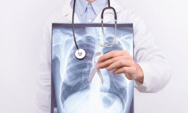 Καρκίνος πνεύμονα: Καινοτόμος ανοσοθεραπεία με ελληνική σφραγίδα