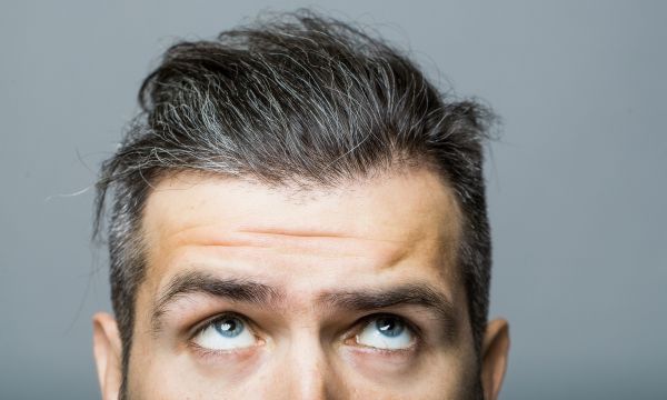 Πιτυρίδα φρυδιών: Τι την προκαλεί και πώς θα απαλλαγείτε