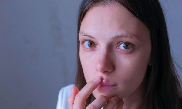 Τι συνδέει έρπη και Αλτσχάιμερ και πρέπει να το ξέρετε