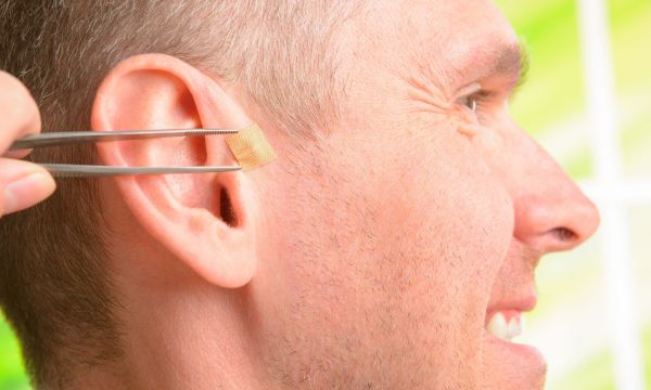 Ear seeding: Όλα όσα πρέπει να ξέρετε για την αρχαία ωτοθεραπευτική μέθοδο