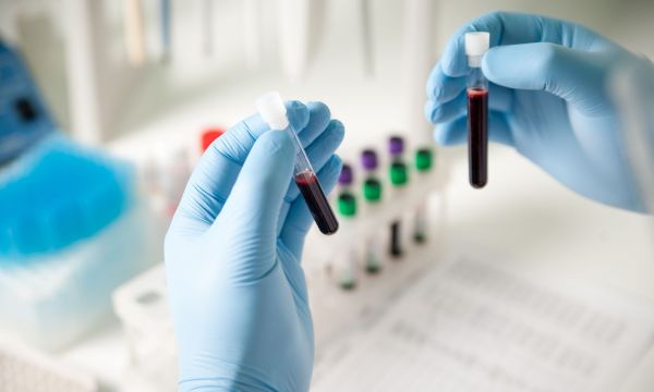 Κλειστά τα ιδιωτικά ιατρικά εργαστήρια στις 7/11 - Γιατί διαμαρτύρονται οι εργαστηριακοί γιατροί