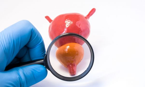 Καρκίνος προστάτη: Μέχρι ποια ηλικία είναι πραγματικά χρήσιμος ο προληπτικός έλεγχος