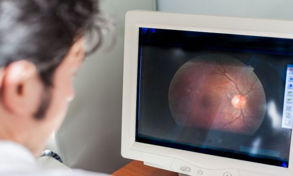 Οφθαλμολογική απεικόνιση μπορεί να αποκαλύψει κίνδυνο για την καρδιακή υγεία