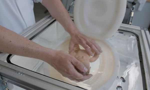 Έρχεται τεχνητή μήτρα για να σώζει πρόωρα βρέφη – Δείτε πώς λειτουργεί [βίντεο]