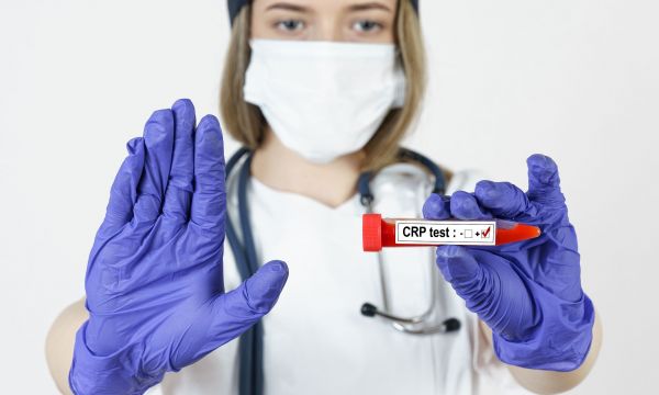 Τι είναι η CRP στις εξετάσεις αίματος — Τι δείχνει η hs-CRP για την καρδιά