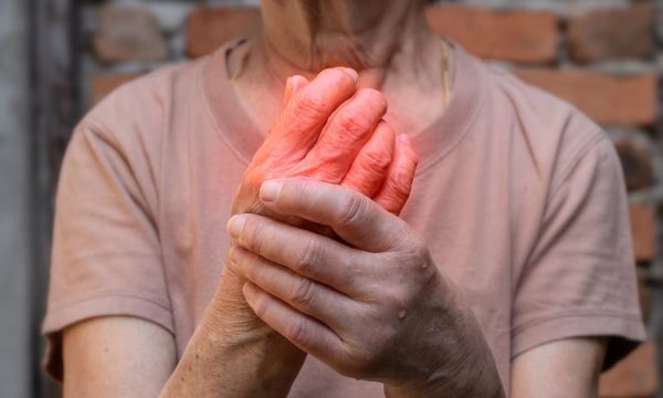 Καυστικός πόνος και πρήξιμο στο δέρμα; Ίσως έχετε ερυθρομελαλγία
