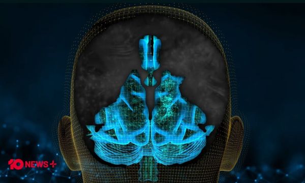 Γεννήθηκε χωρίς ημισφαίρια εγκεφάλου αλλά μόλις έκλεισε τα 20 – Τι είναι η υδρανεγκεφαλία [vid]