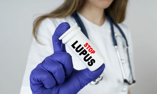 Ο Λύκος συνδέεται με ιό που φέρει το 95% των ανθρώπων – Πλέον ξέρουμε και πώς