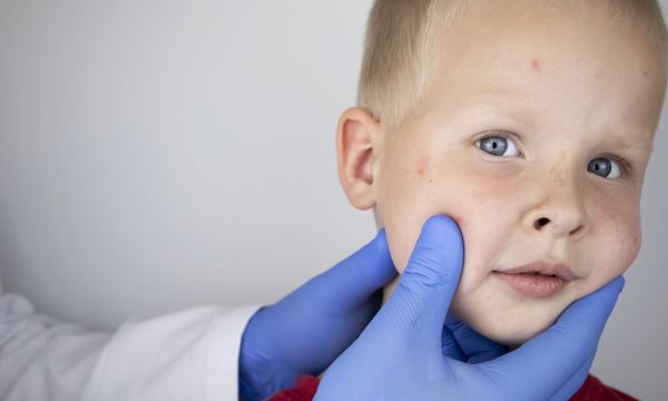 Ποια νόσος που δεν έχει θεραπεία ήταν σε ύφεση, αλλά εξαπλώνεται ξανά παγκοσμίως