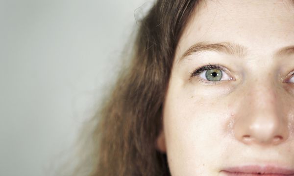 Πώς η νεφρική νόσος επηρεάζει το πρόσωπο: Ποιες αλλαγές σηματοδοτούν πιθανό πρόβλημα