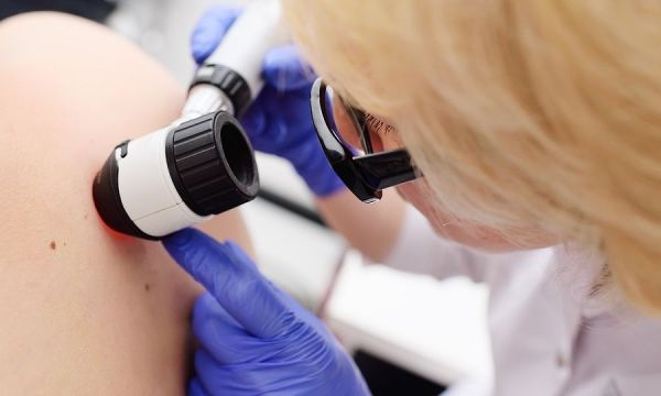 «Εμβόλιο» για το μελάνωμα: Συνδυαστική θεραπεία μειώνει τον κίνδυνο υποτροπής ή θανάτου κατά 49%
