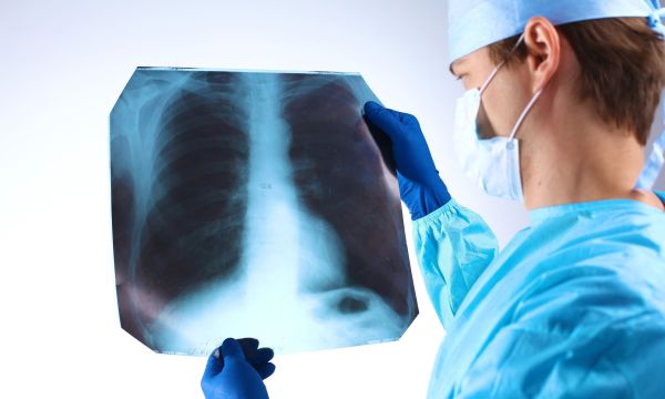 33χρονος επέζησε 2 μέρες χωρίς πνεύμονες - Πώς τον έσωσαν μέχρι να γίνει διπλή μεταμόσχευση