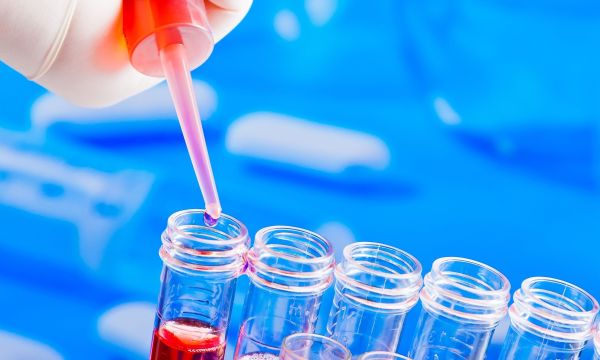 Τα πρώιμα σημάδια Πάρκινσον μπορούν να εντοπιστούν στο αίμα