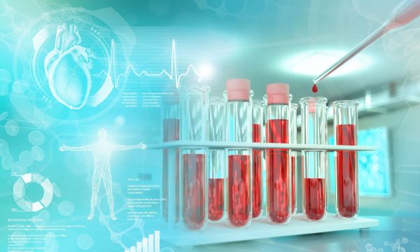 Υπερκαλιαιμία: Τι σημαίνει το αυξημένο κάλιο στο αίμα και οι πιθανές αιτίες