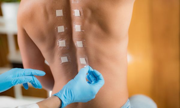 Αλλεργικές αντιδράσεις: Πώς γίνεται ένα τεστ επικόλλησης στο δέρμα