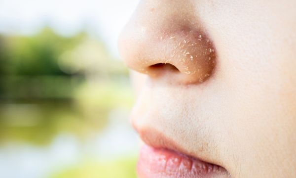 Σημάδια και συμπτώματα ανεπάρκειας βιταμίνης Β6