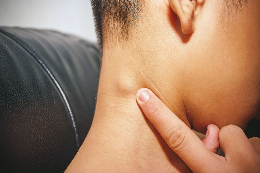 Lymph-Node-lemfadenas