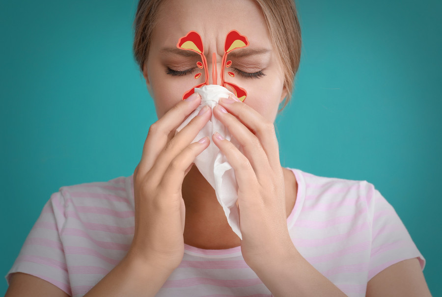 sinusitis-igmoritida