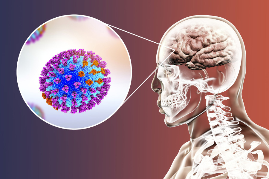 Influenza-Brain-Encephalitis-griph-egkefalitida-egkefalos-ios
