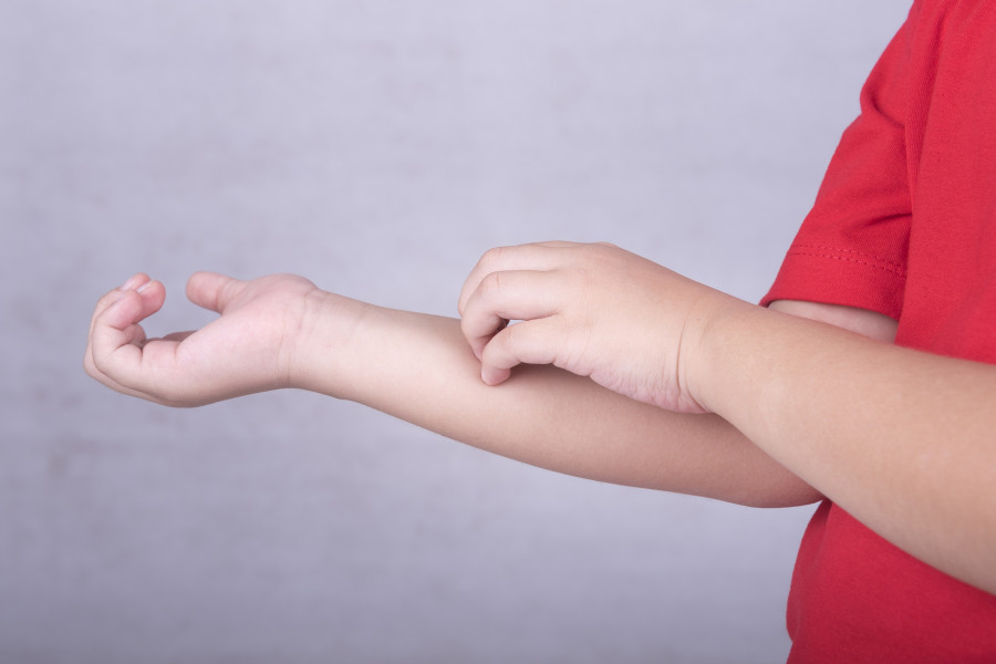 Itch-skin-dermatitis-eczema