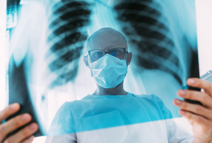 Doctor-Chest-X-ray-Lungs-Scan-Radiology