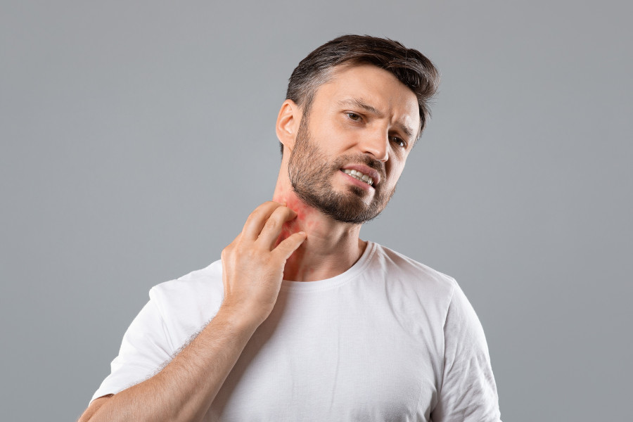 Scratching-Neck-itch-rash-Allergic-reaction-eczema
