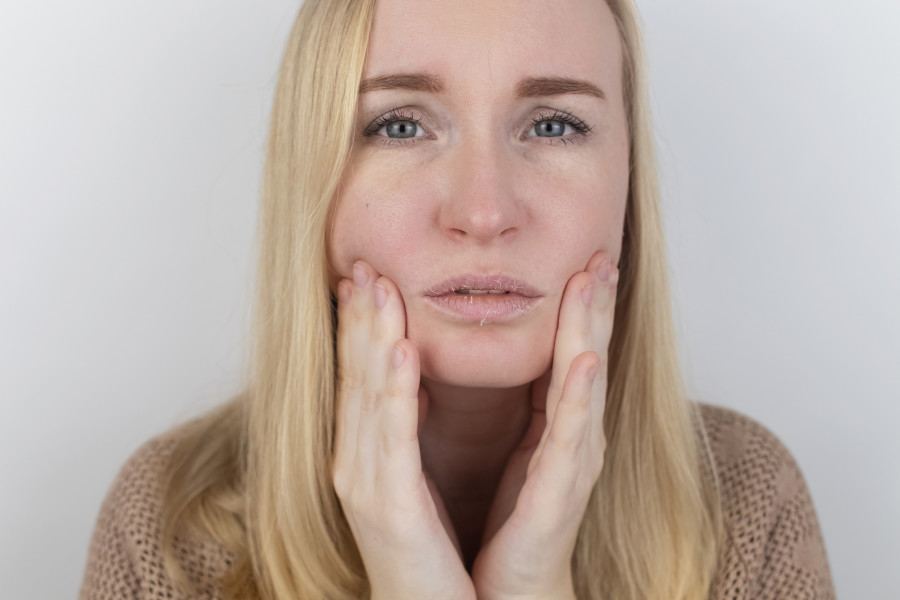 Dry-Skin-Lips-Peeling-Discomfort