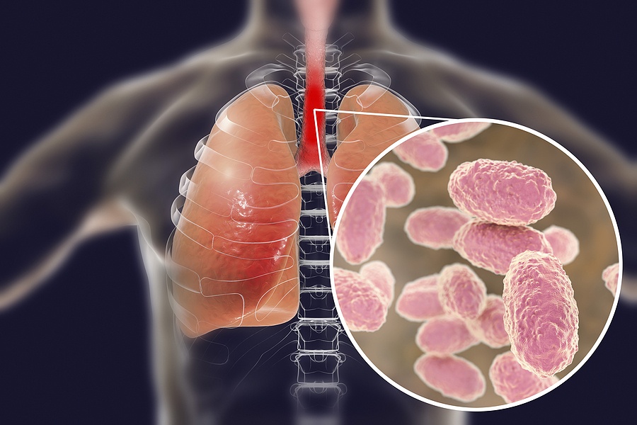 Whooping Cough Bacteria Bordetella Pertussis