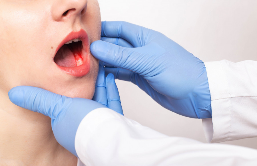 girl with a bad tooth with pulpitis, gum disease, fluorosis