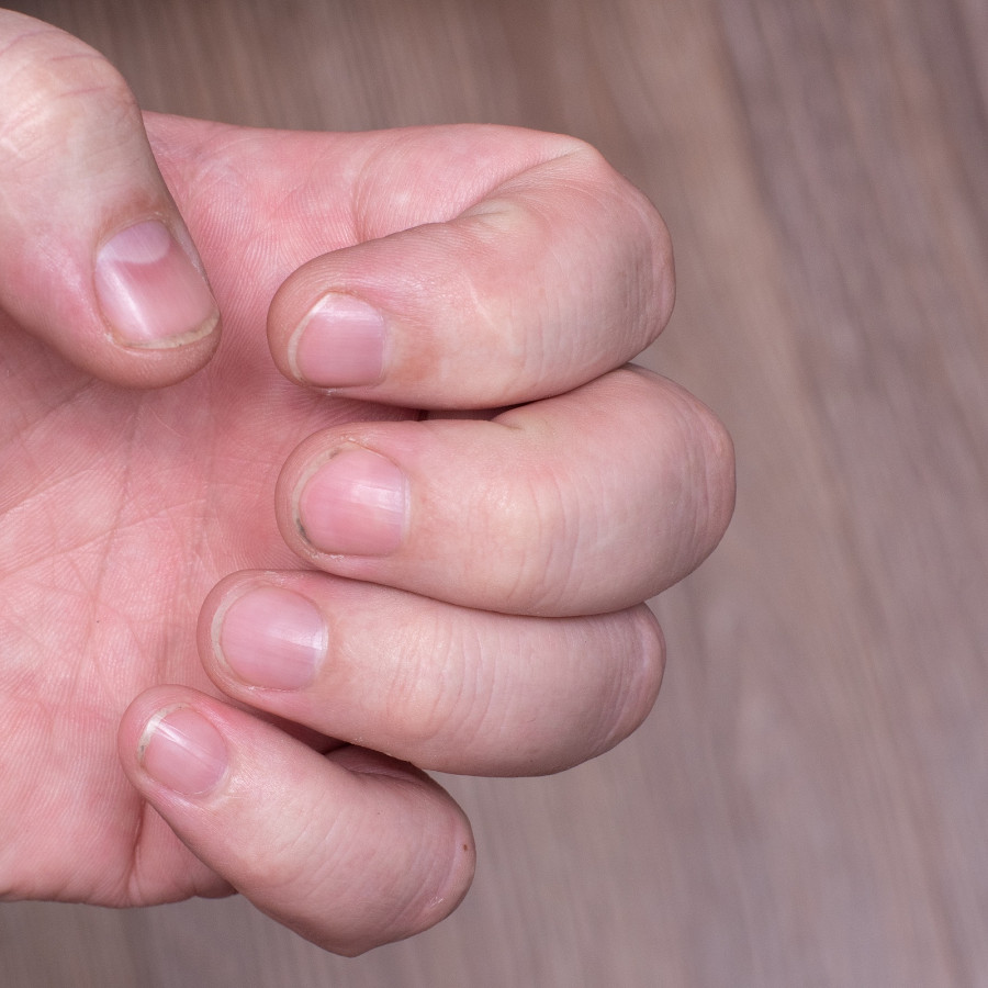 Close-up Of Short Dirty Nails, Caucasian Male Hand