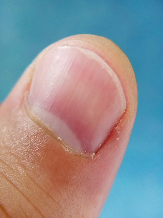 Man Finger
