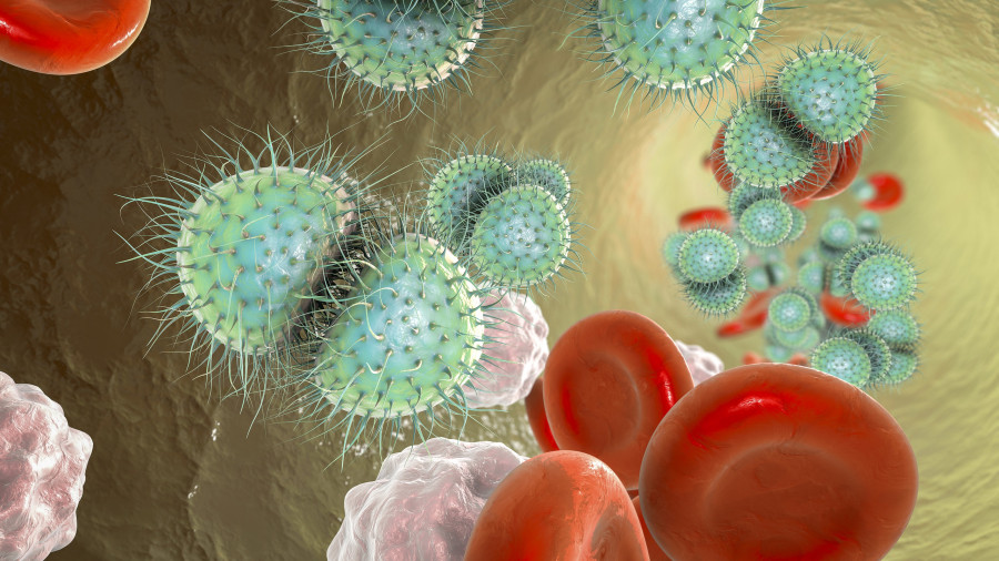 Meningococcemia, The Dissemination Of Bacteria Nesseria Meningitis
