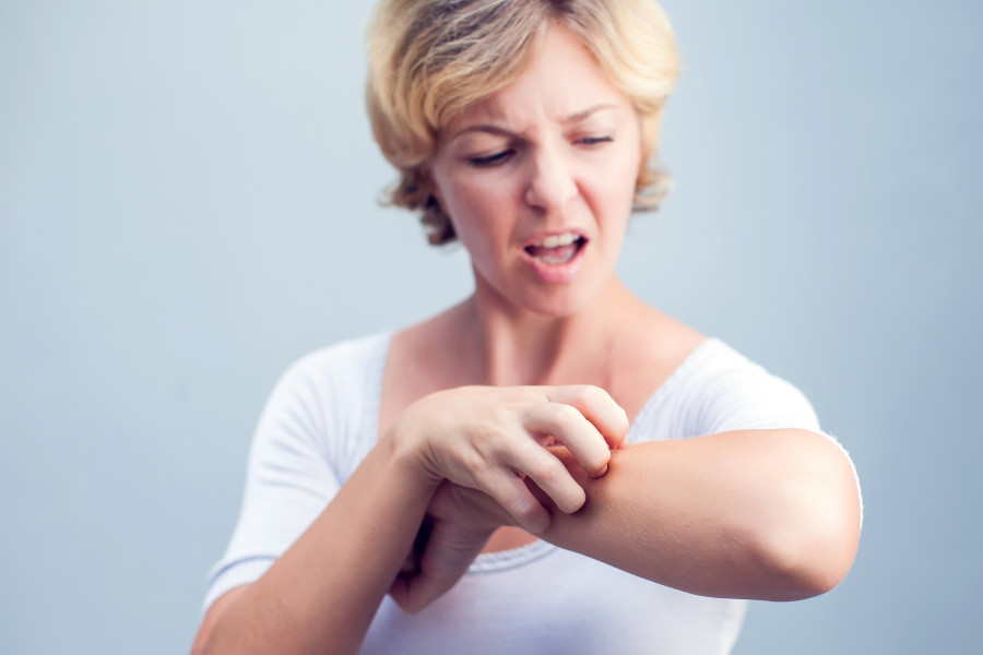Woman Scratching An Itch Sensitive Skin, allergy symptoms, Irritation