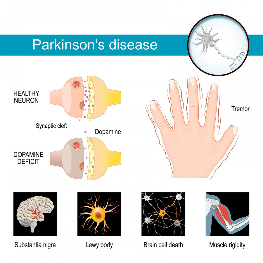 Parkinson's Disease