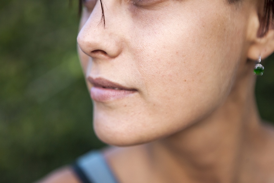 Pigmented spots and freckles