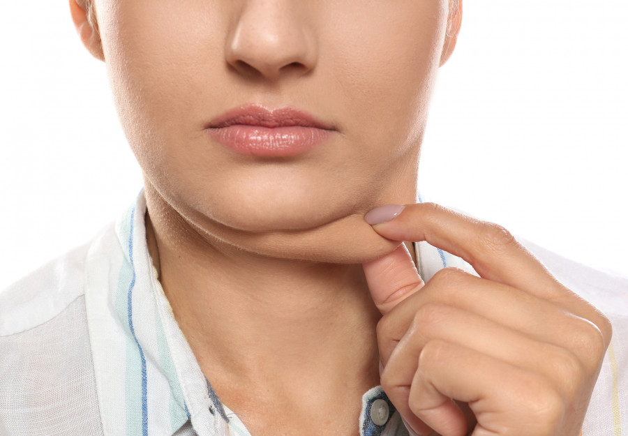 Woman With Double Chin