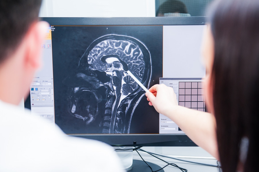 Doctors Magnetic Resonance Image (mri) Of The brain