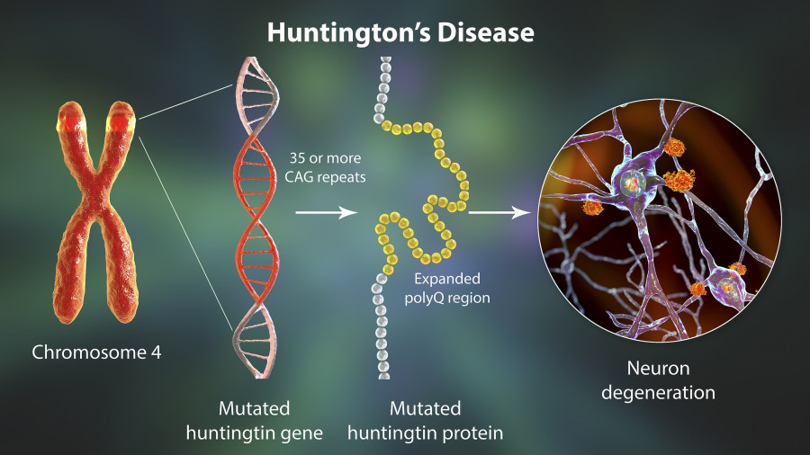 Huntingtons Disease
