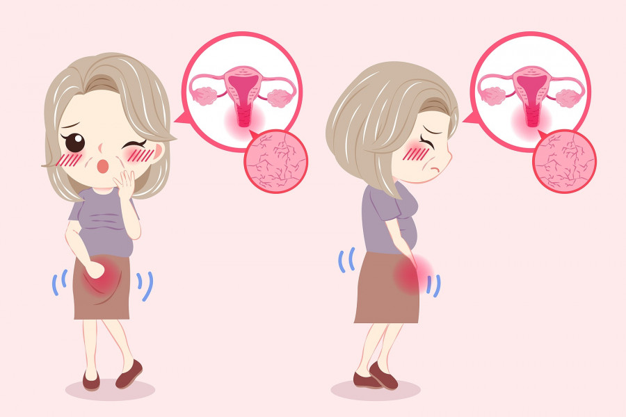 Woman With Menopause And Vaginal Dryness